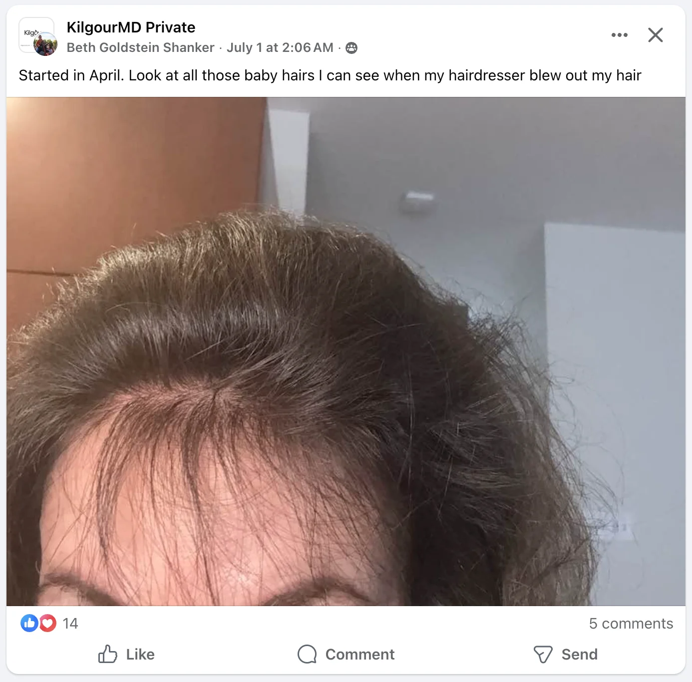Beth's results