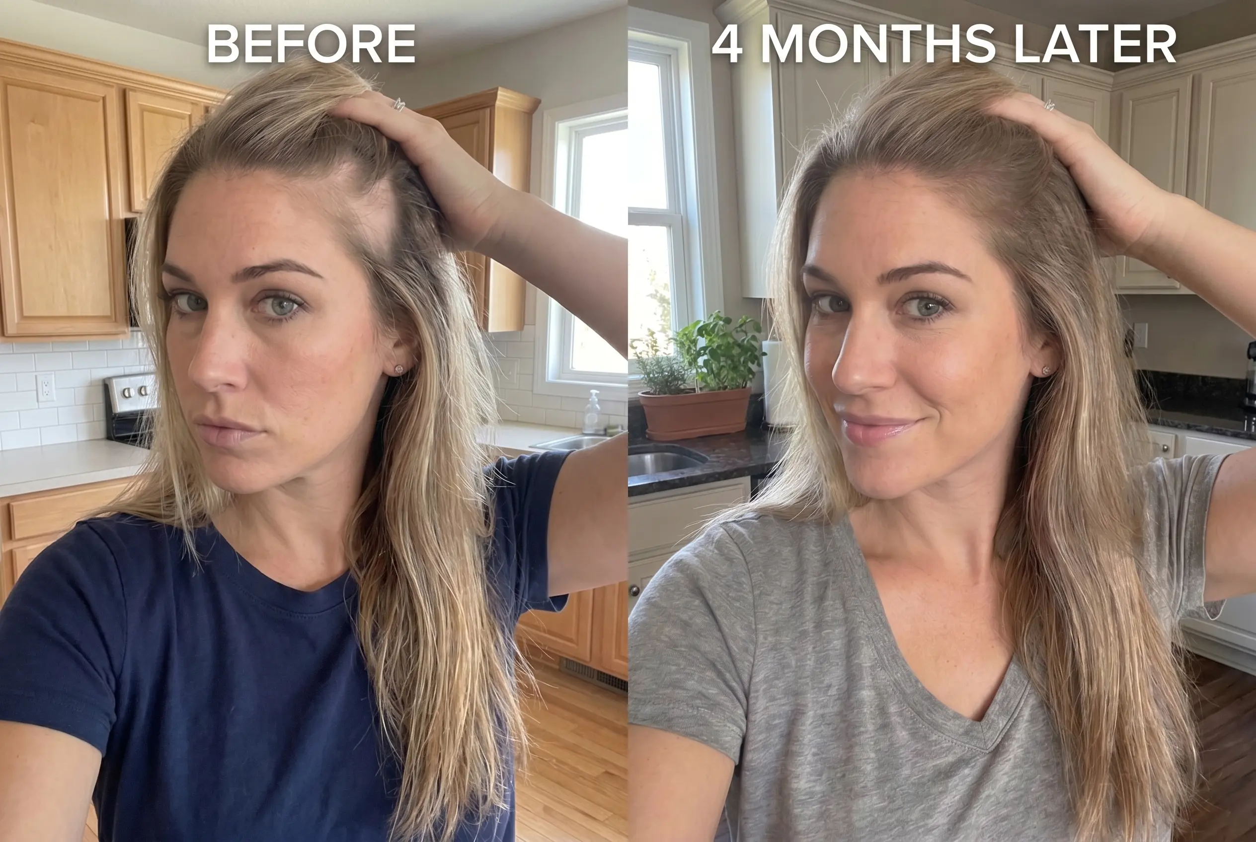 Chloe &mdash; before and after