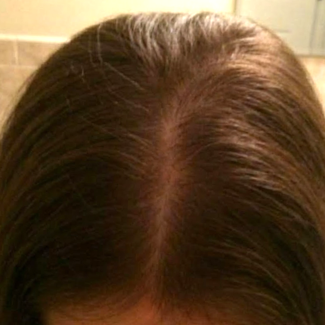 Close-up of a person's hair parting showing scalp.