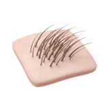 Scalp
