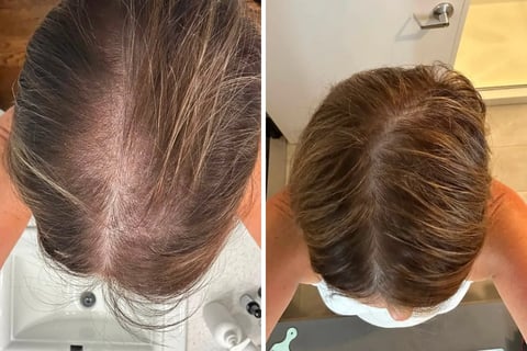 90 day results