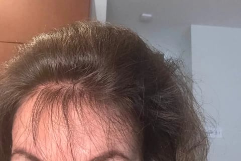 Baby hairs