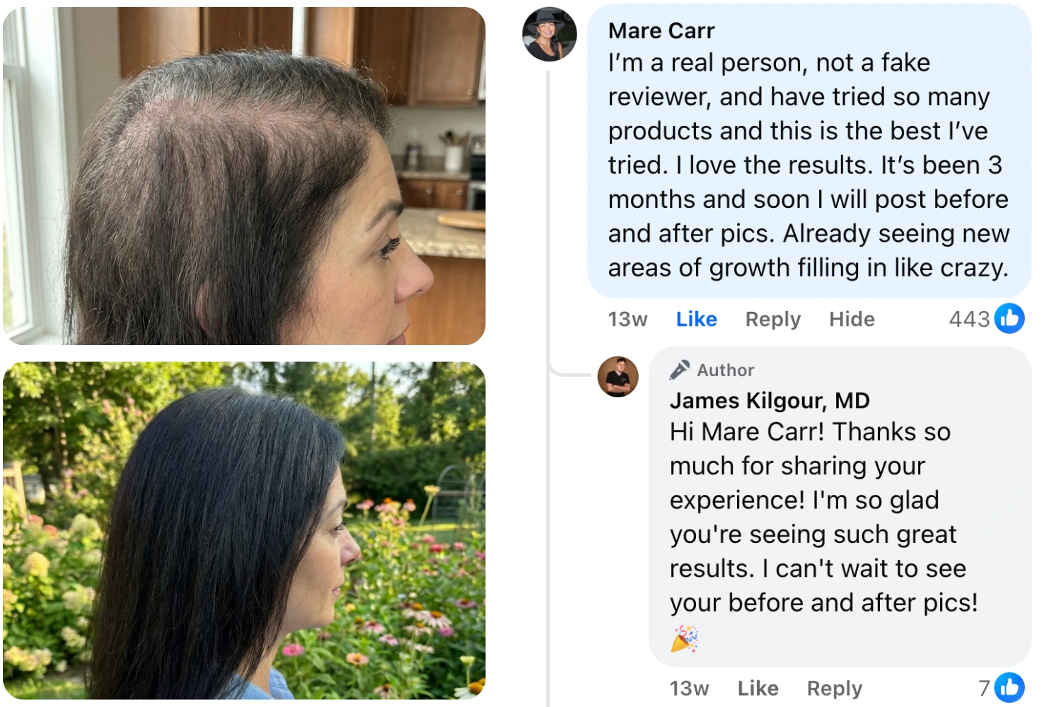 Before and after photos of a woman's hair growth, next to a positive social media review.