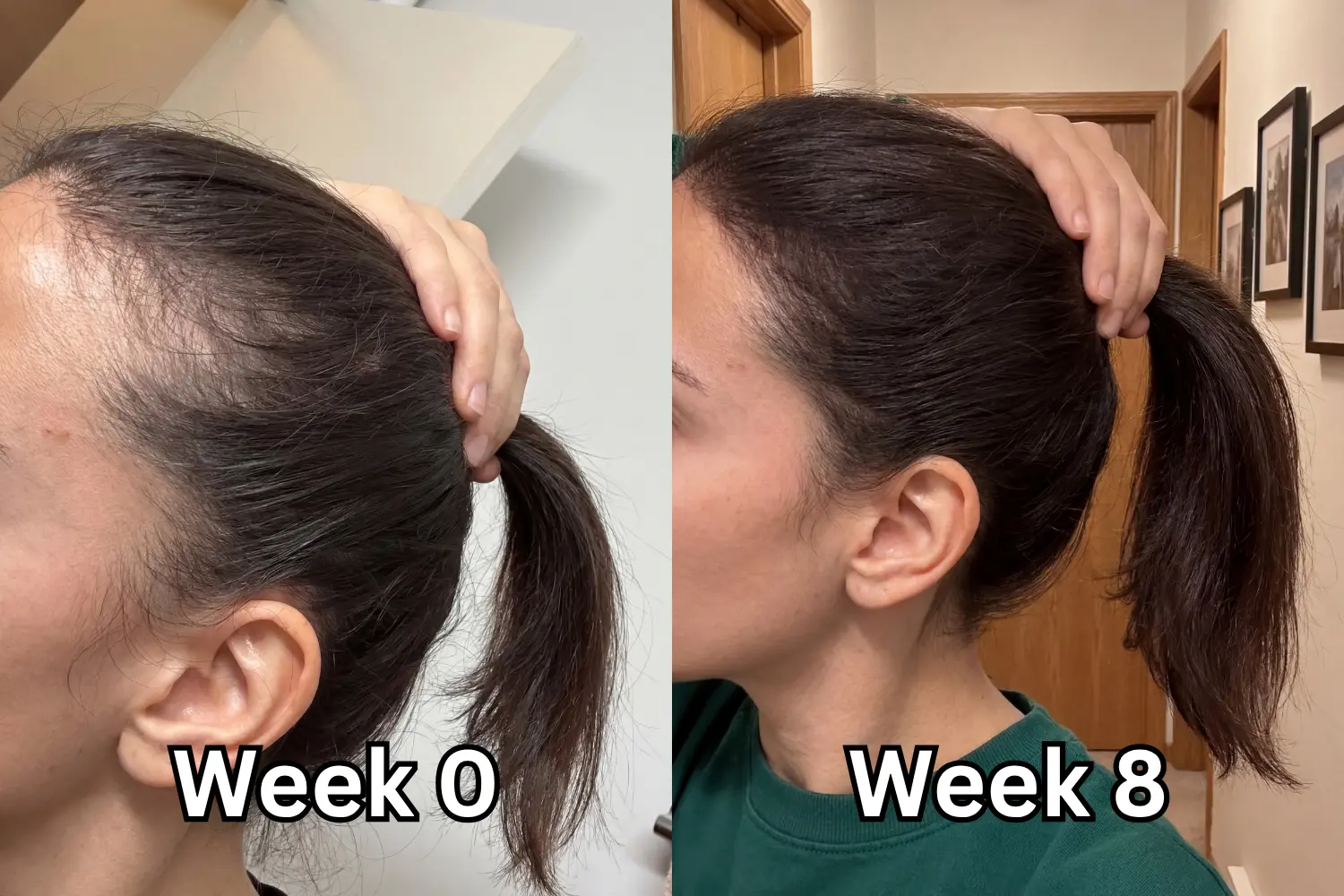 Side-by-side photos of a woman pulling her hair into a ponytail showing hairline regrowth, Week 0 (left) vs Week 8 (right)