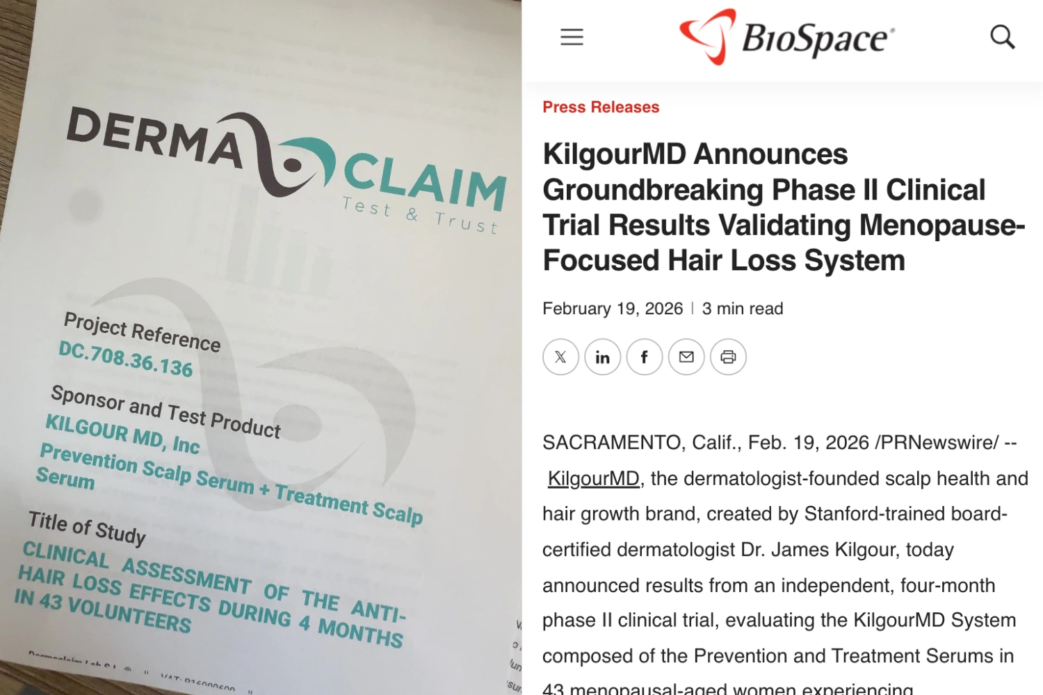 A split image showing a clinical study document alongside a press release for a hair loss system.