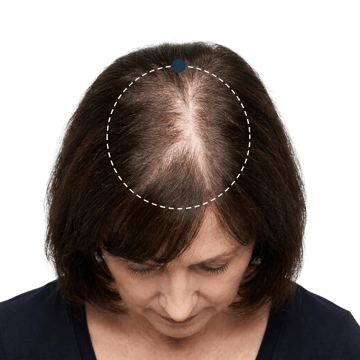Crown &mdash; before