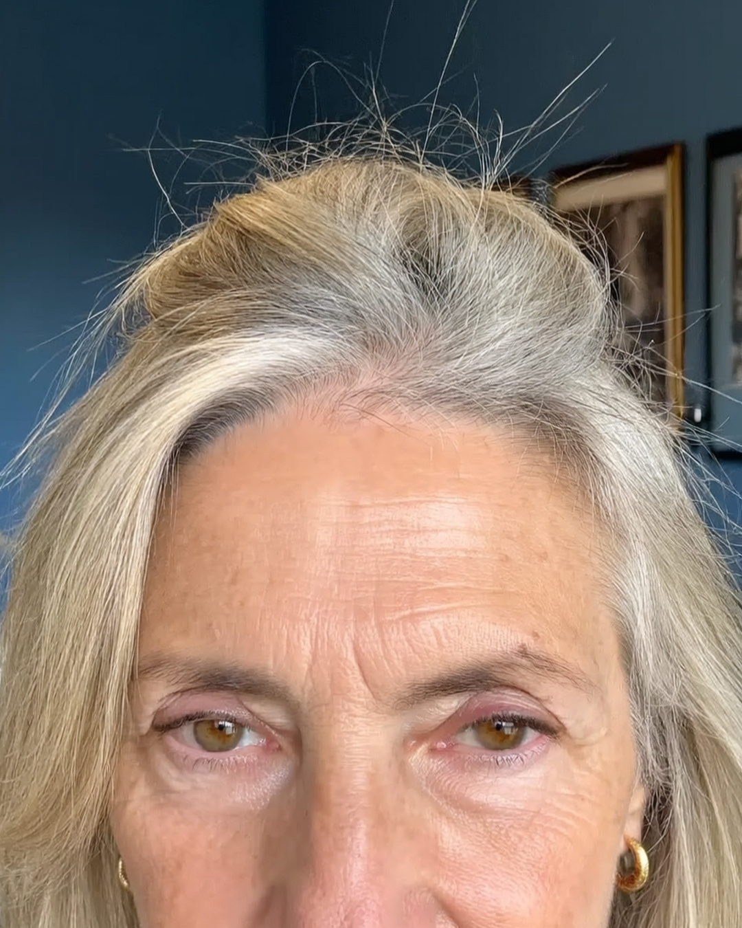 Close-up of a person's forehead and eyes with light hair.