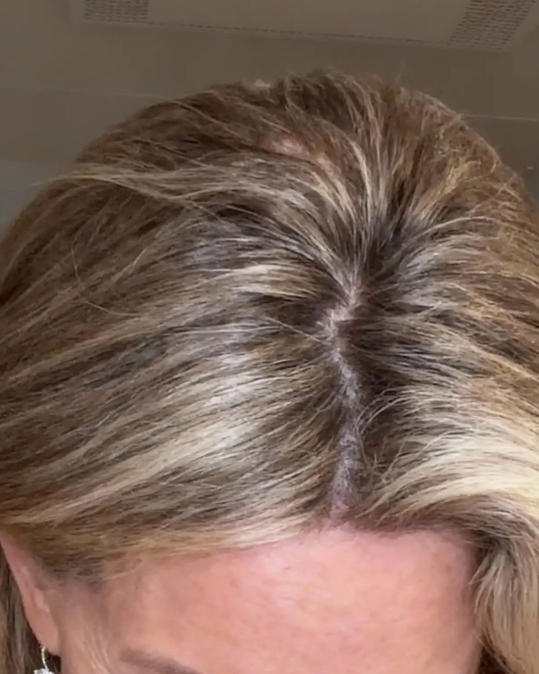 Close-up view of the top of a person's head with light brown hair.