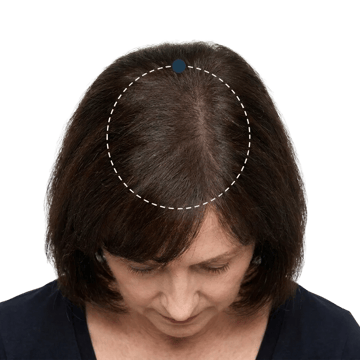 Crown &mdash; after