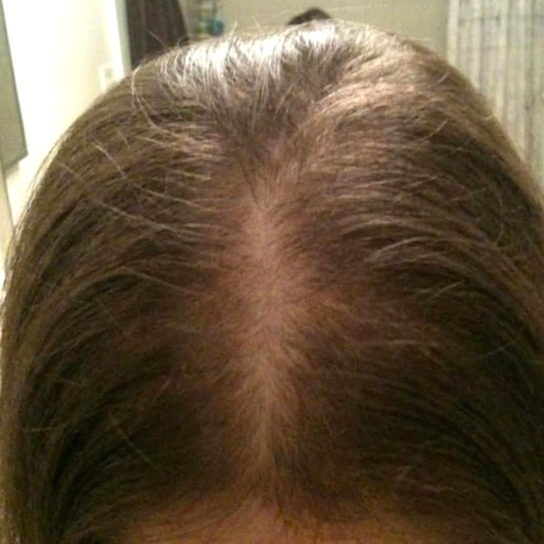 Close-up of a person's scalp with parted brown hair.