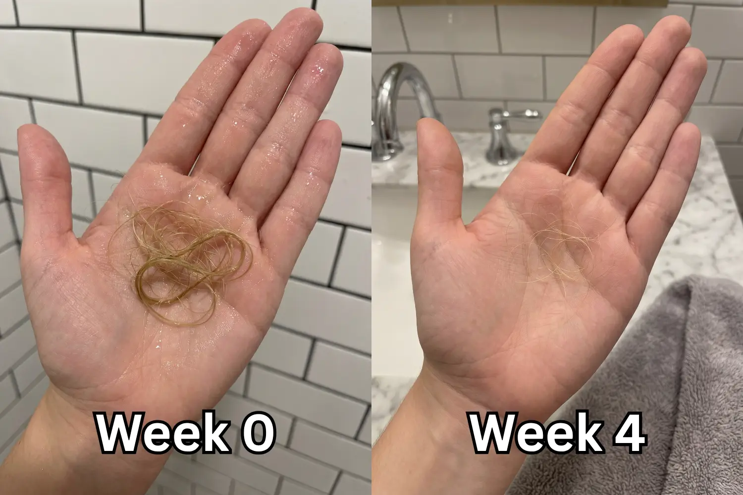 Side-by-side palms showing hair-loss improvement, left palm with a large clump of hair labeled Week 0, right palm with few strands labeled Week 4 in a bathroom