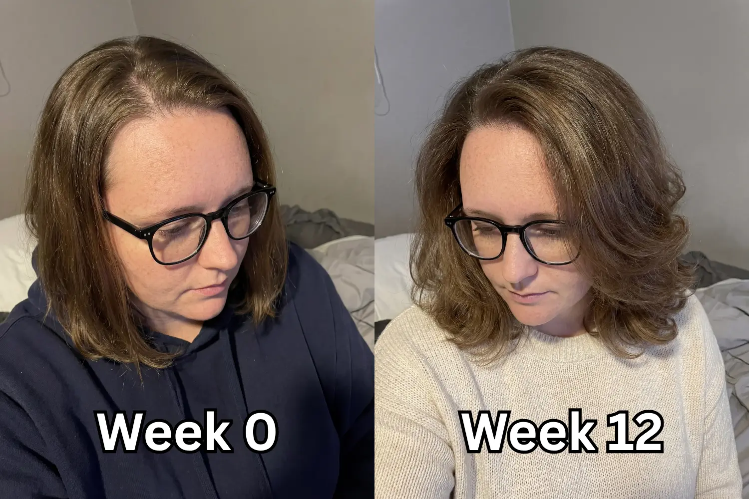 Side-by-side photos of a woman looking down — left labeled Week 0 with flatter, thinner hair; right labeled Week 12 with fuller, lifted hair