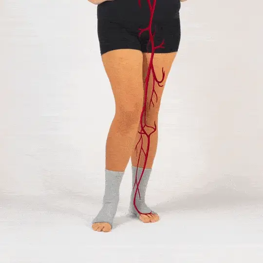 Person wearing black shorts and gray socks with red vein illustration on leg.