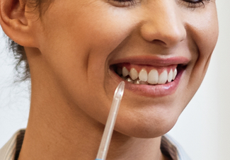 Person smiling with a dental tool near their teeth.