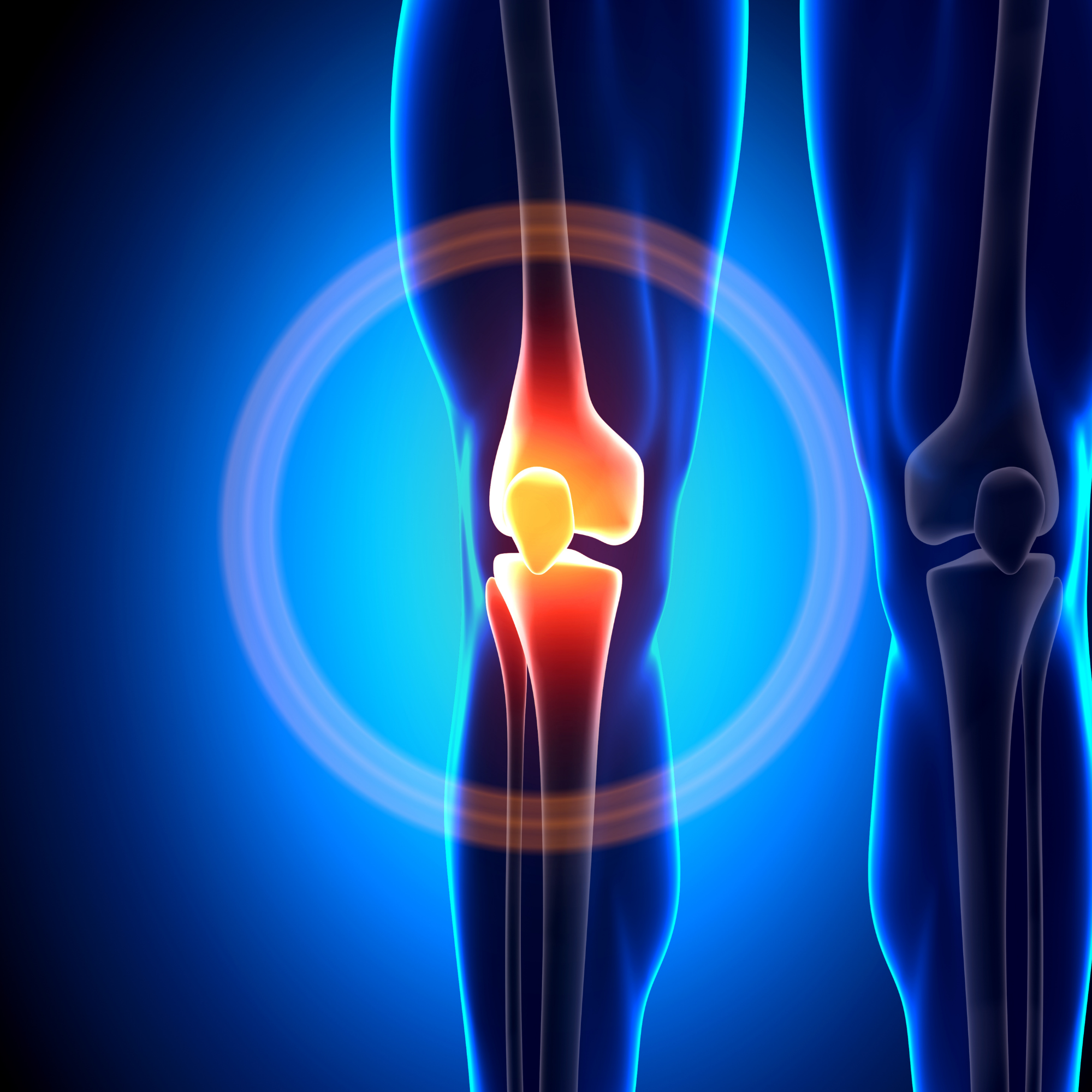 Illustration of a human knee joint with highlighted inflammation.