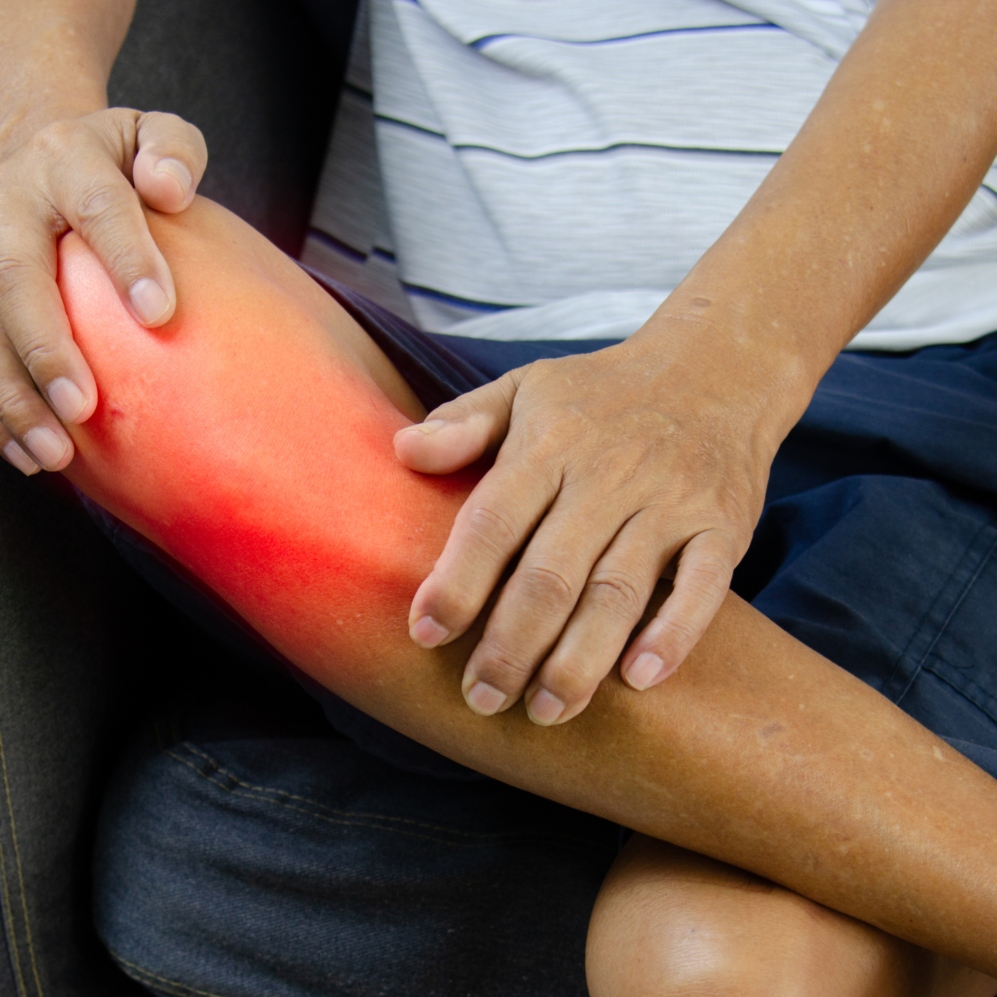 Person holding a red, inflamed knee, indicating pain or injury.