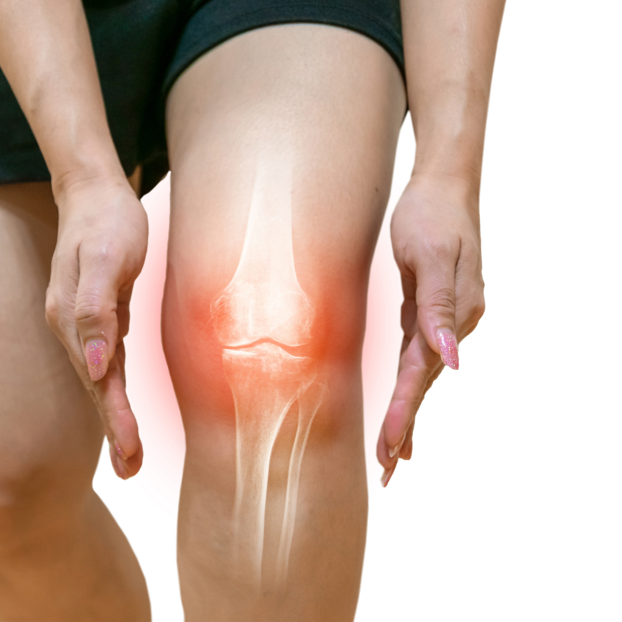 Person holding knee with highlighted joint and bones visible.