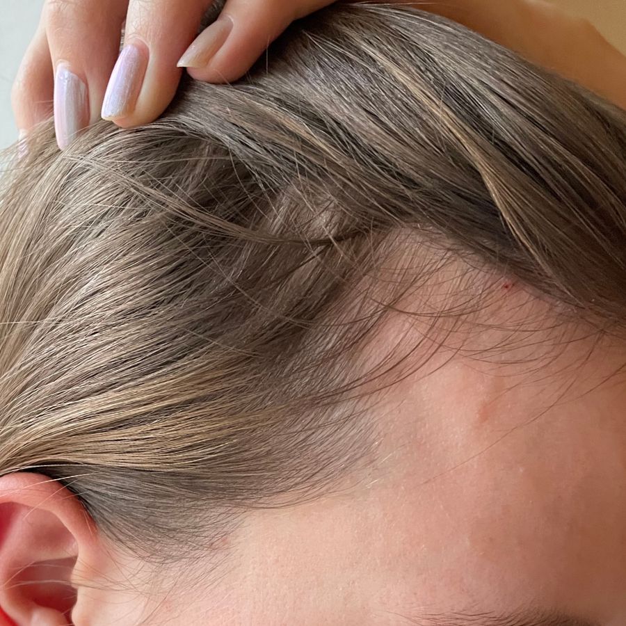 Close-up of a person's scalp with fingers parting the hair.