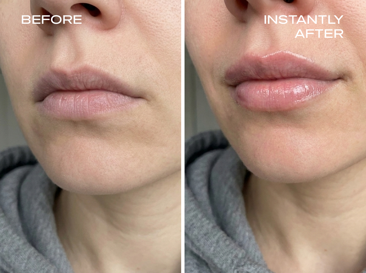 A before and after photo comparison of a person's lips, showing them looking glossier and fuller after.