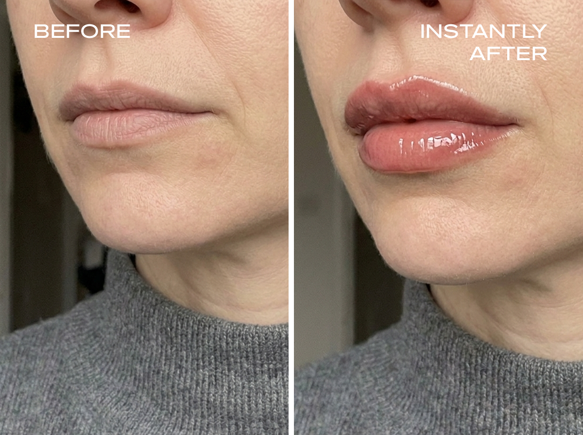 A before-and-after image showing a woman's lips looking fuller and glossier in the after photo.