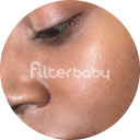 Close-up of a person's cheek with smooth skin and a watermark saying 'filterbaby.'