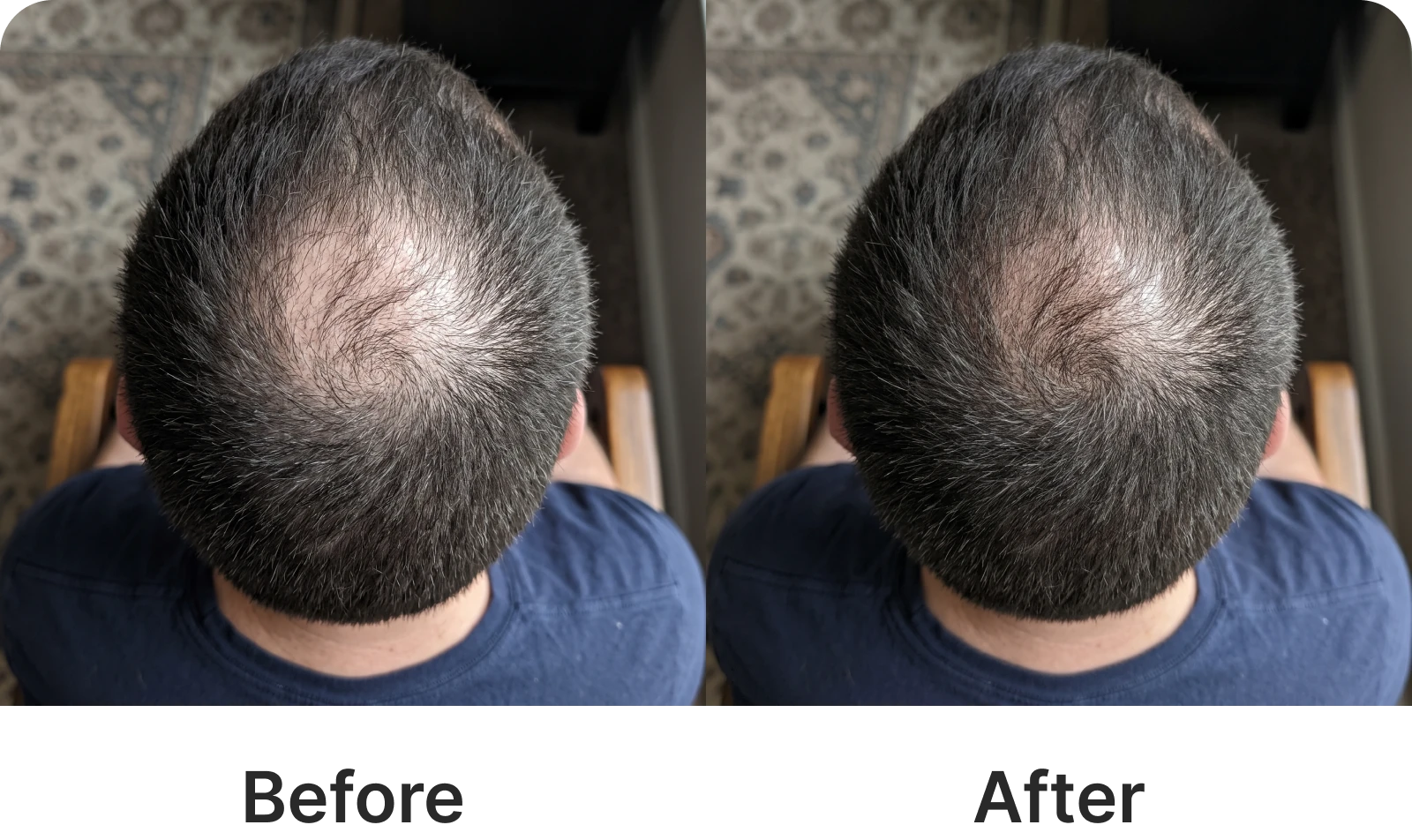 Before and after photos showing hair on the crown of a man's head looking visibly thicker.
