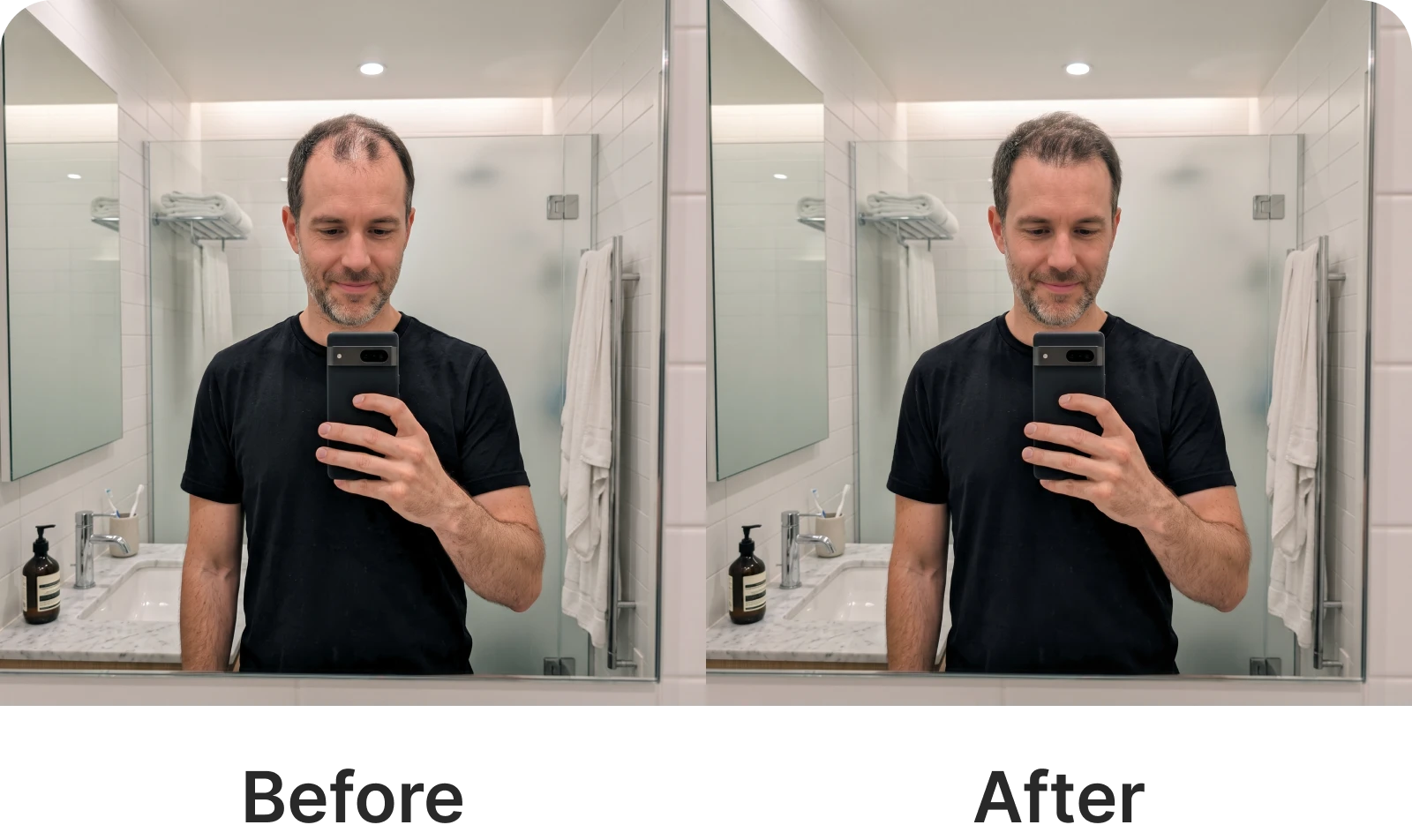 A before and after comparison of a man with thinning hair, showing a fuller head of hair afterwards.