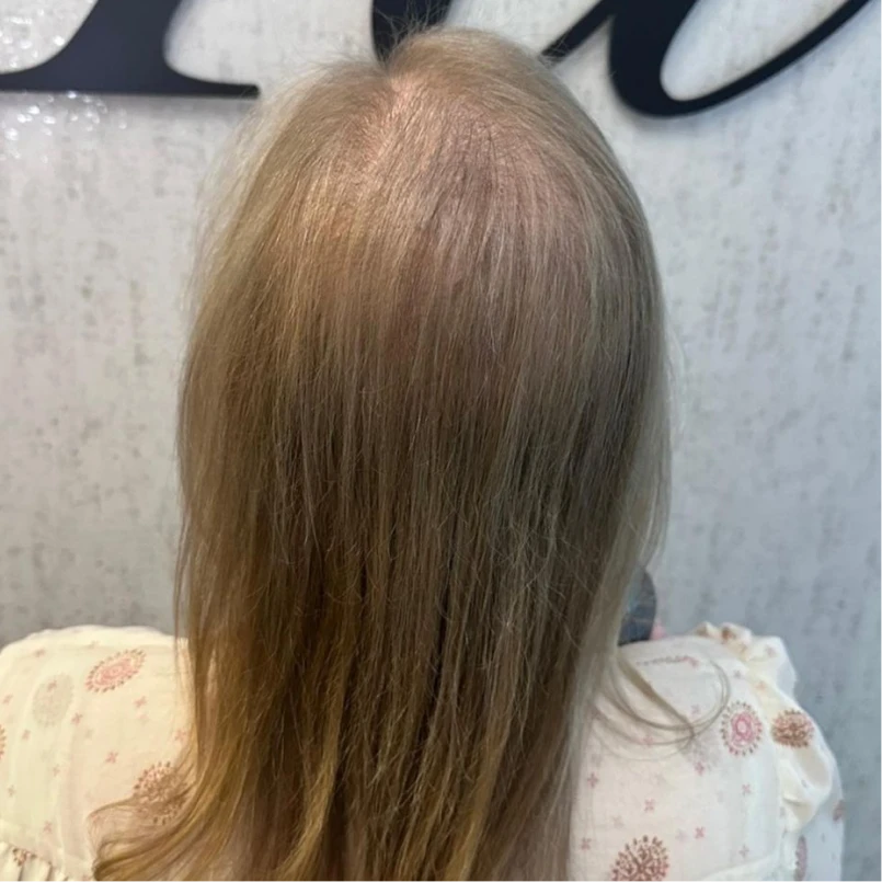 Back view of a person with long, blonde hair and a patterned shirt.