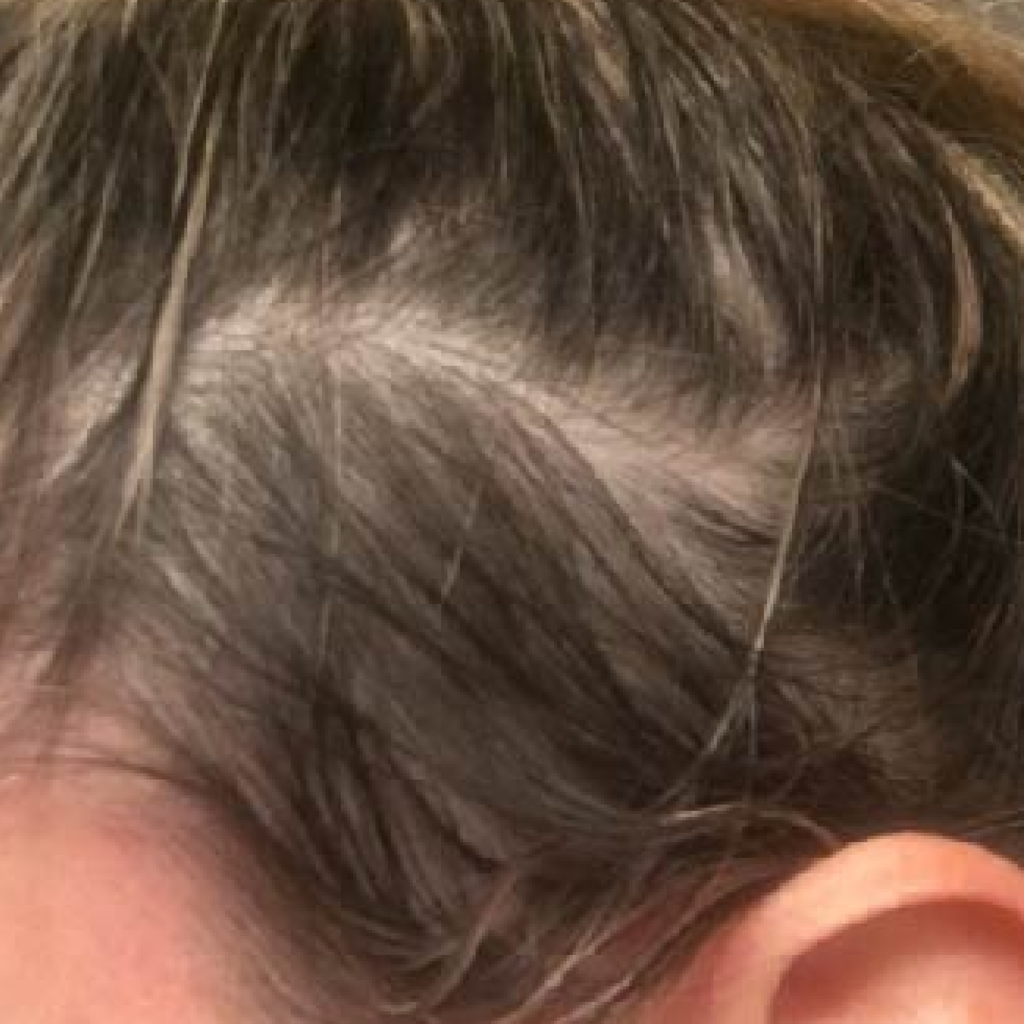 A close-up of dark hair on a person's scalp, with the top of an ear visible.
