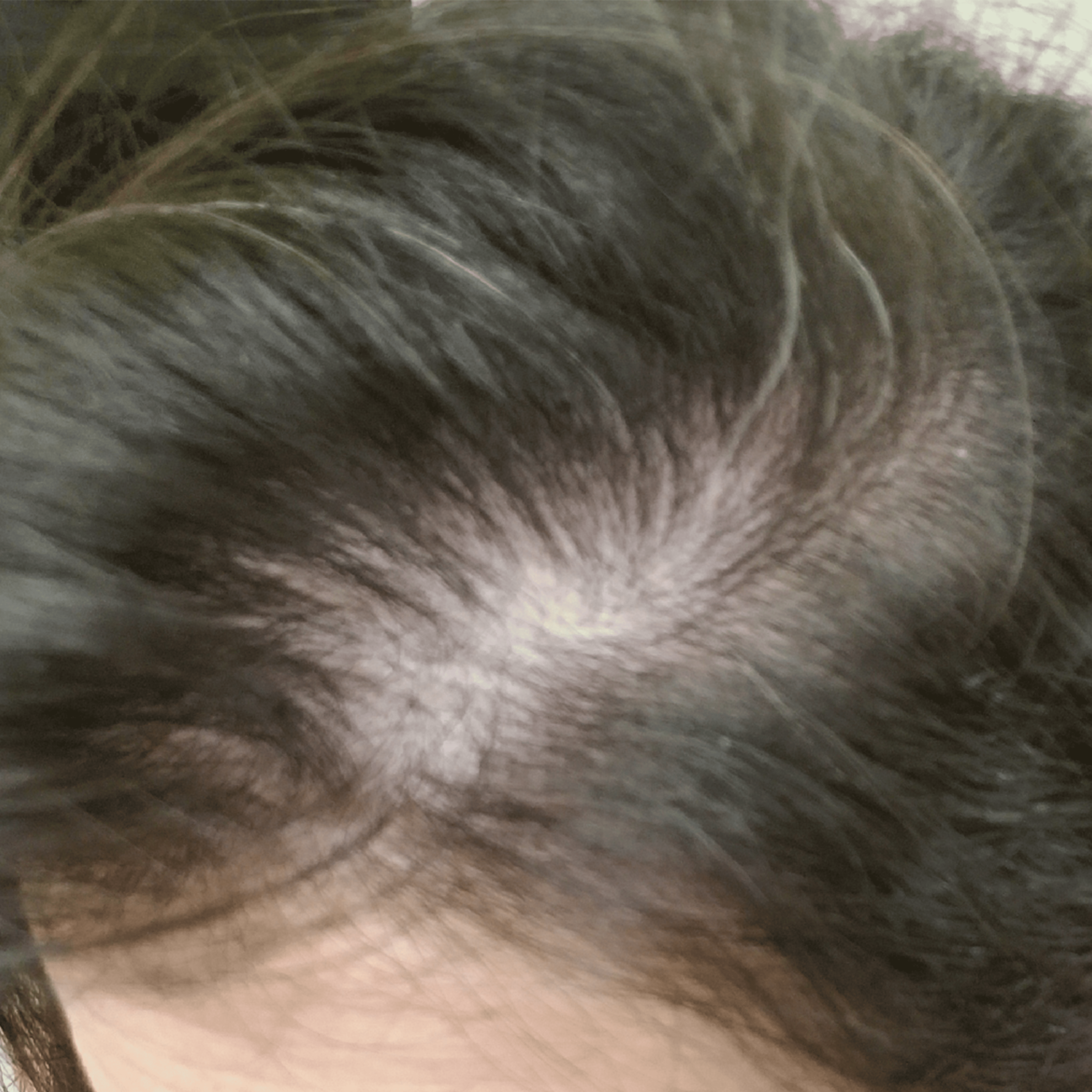 A close-up, slightly blurry view of thinning dark hair on a person's scalp.