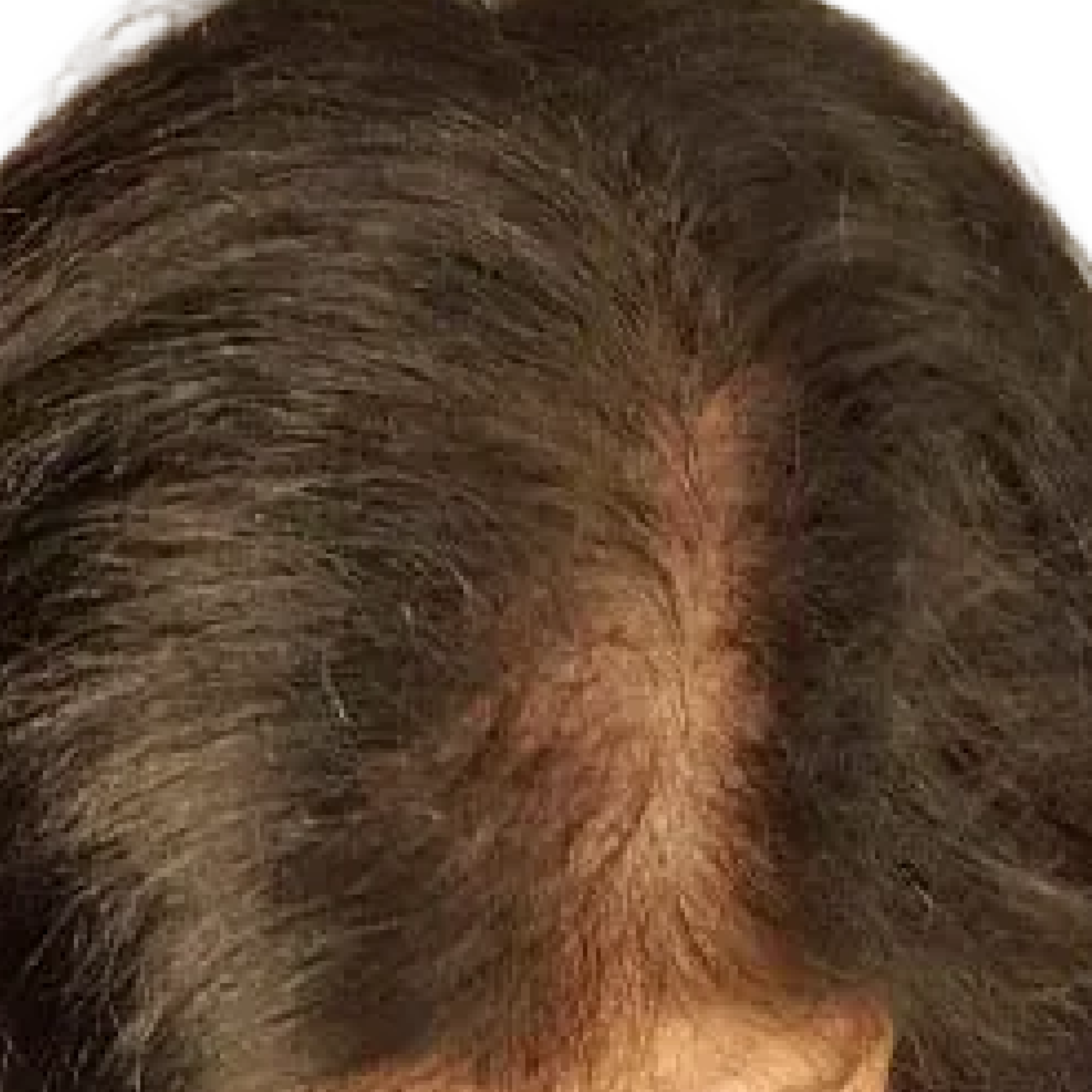 A close-up of a person's scalp with thinning dark brown hair parted in the middle.