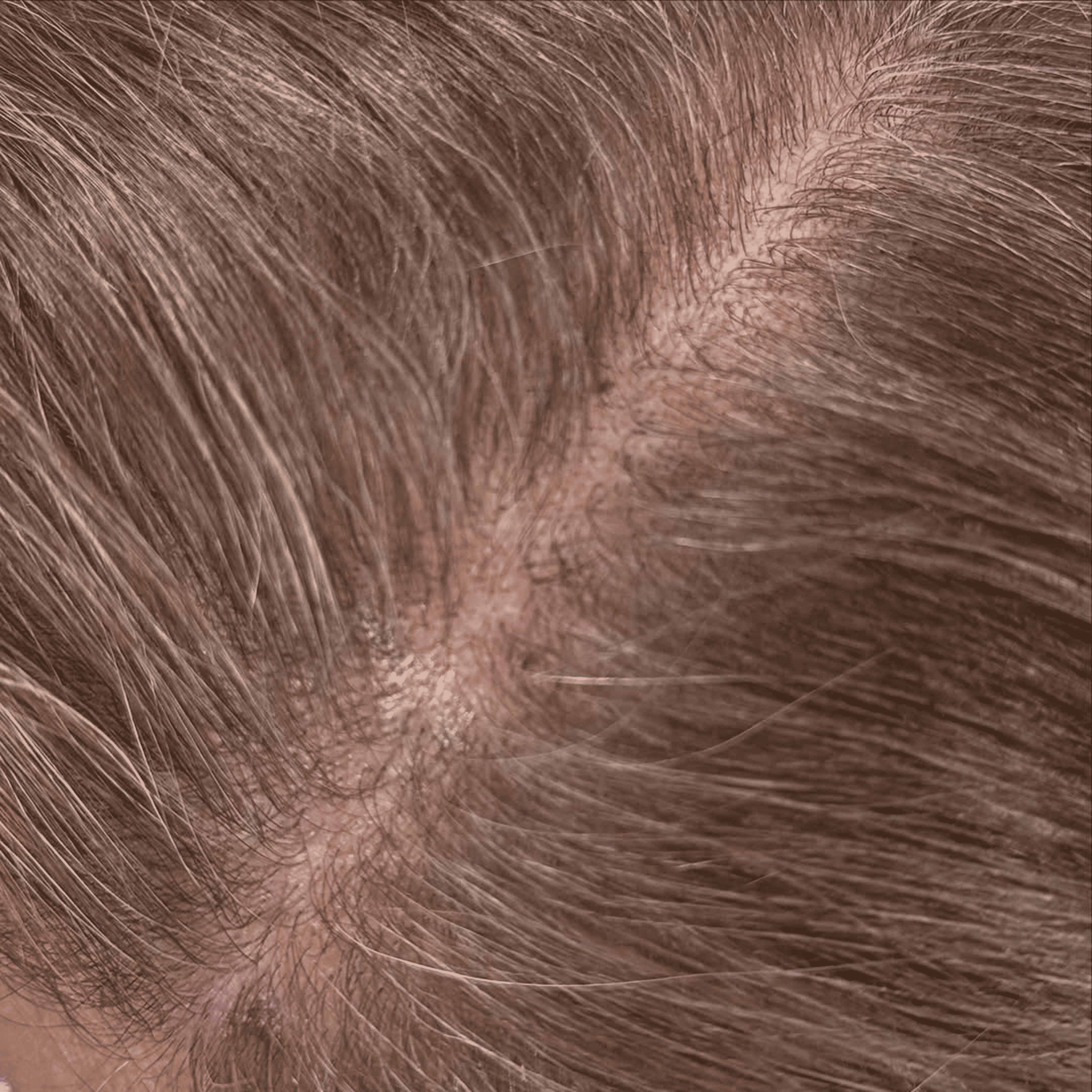 A close-up, sepia-toned image showing the scalp and roots of a person's hair.