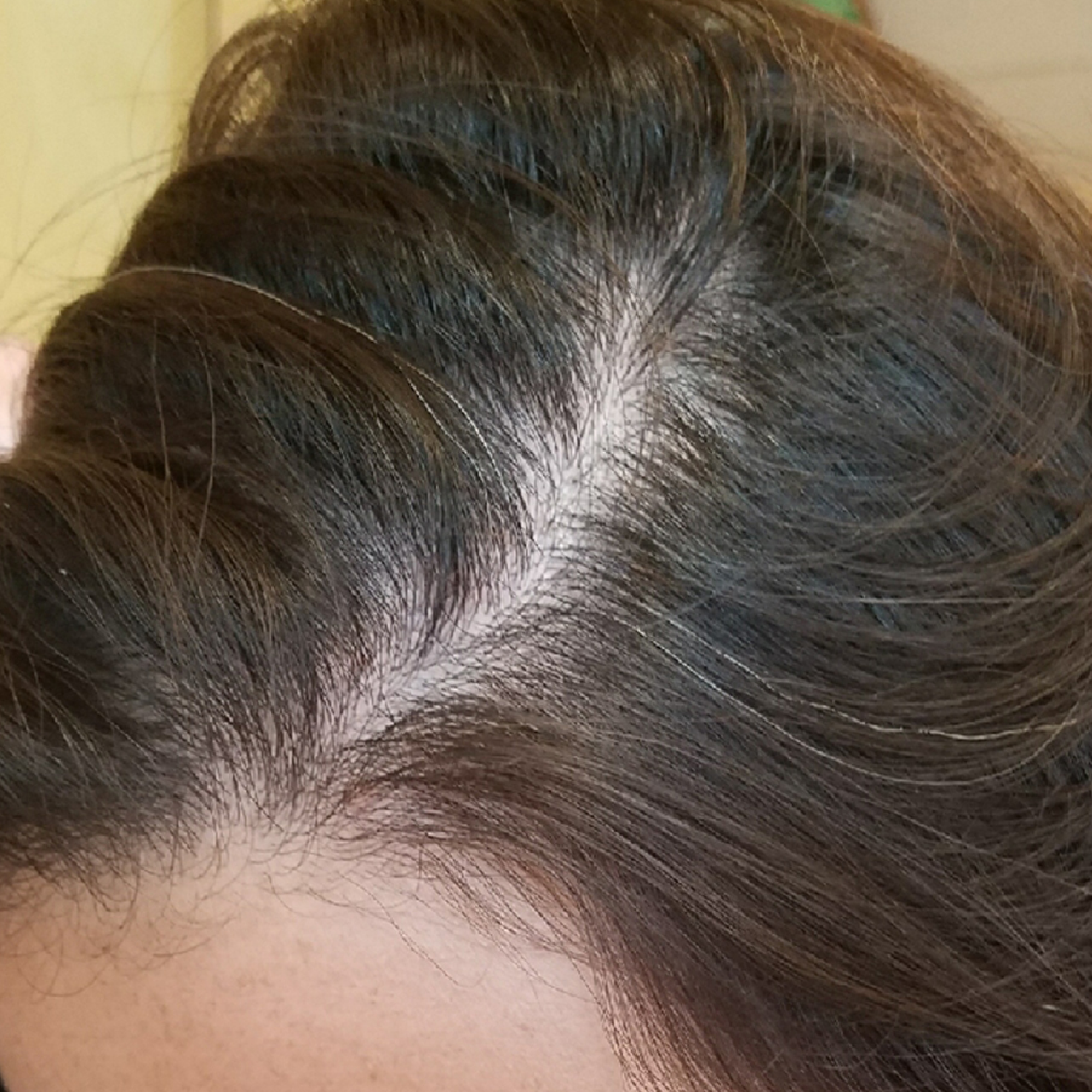 A close-up of dark hair parted down the middle, showing the scalp and some gray hairs.