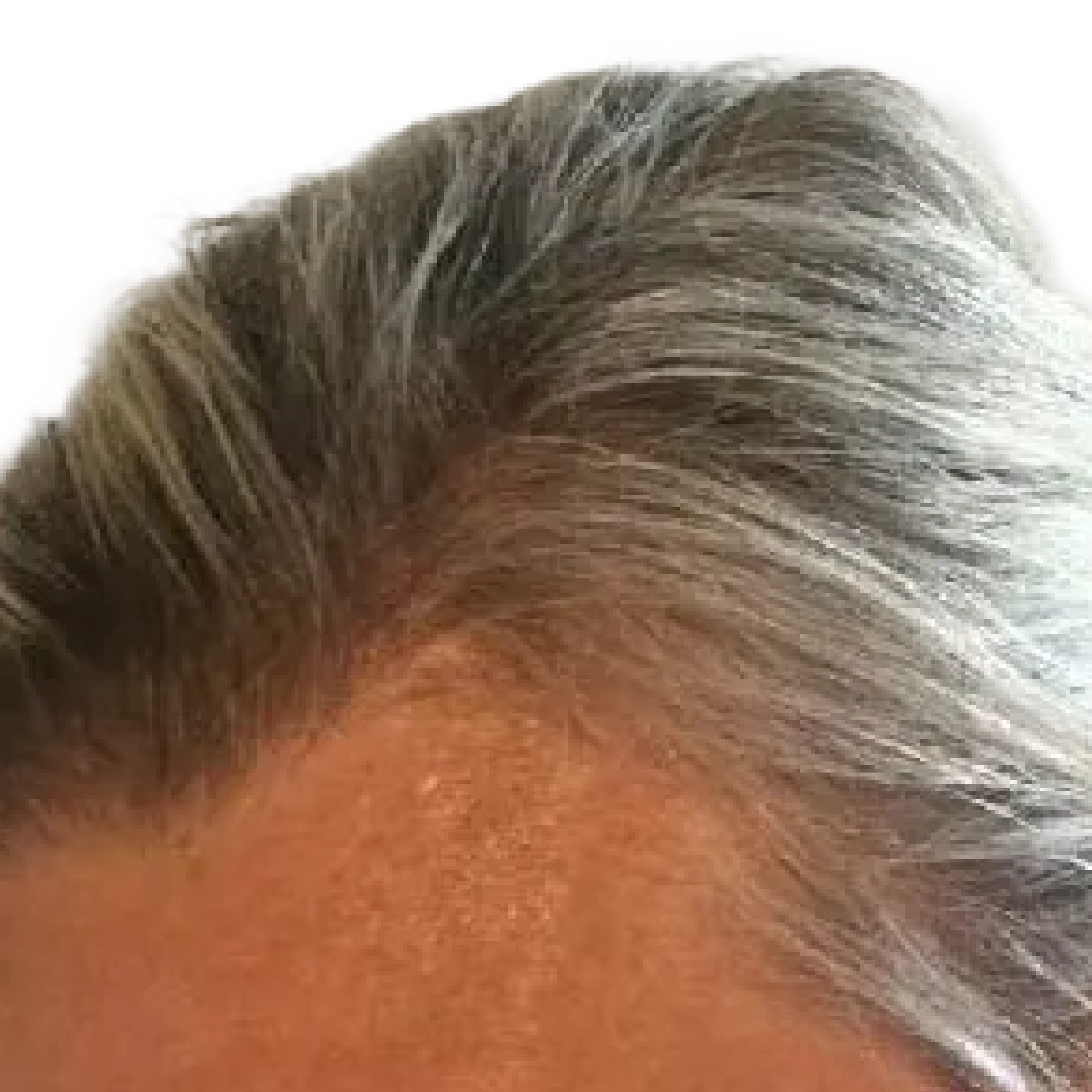 A close-up of a person's hairline, showing thick, graying hair against a white background.