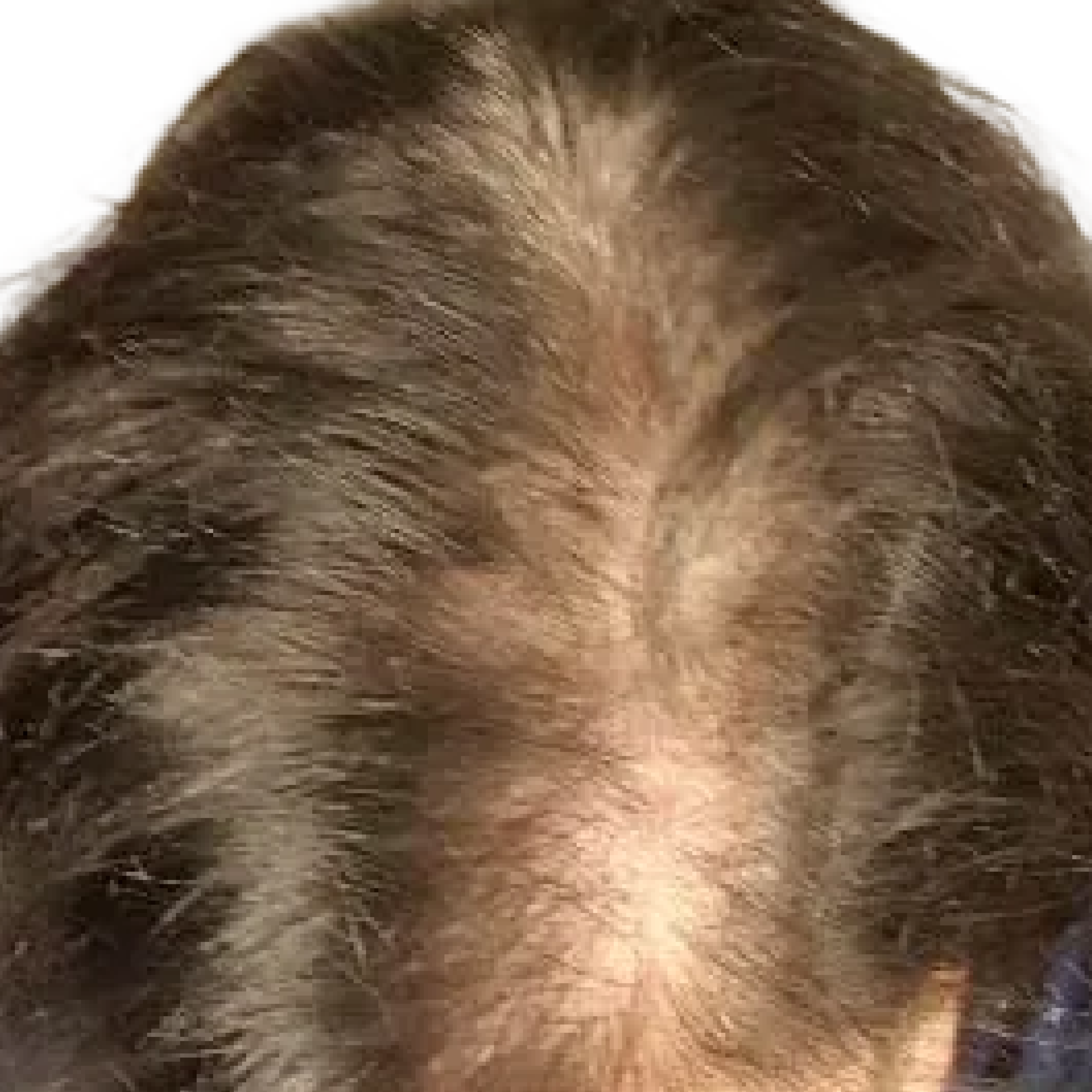 A close-up, top-down view of a scalp with thinning brown hair.