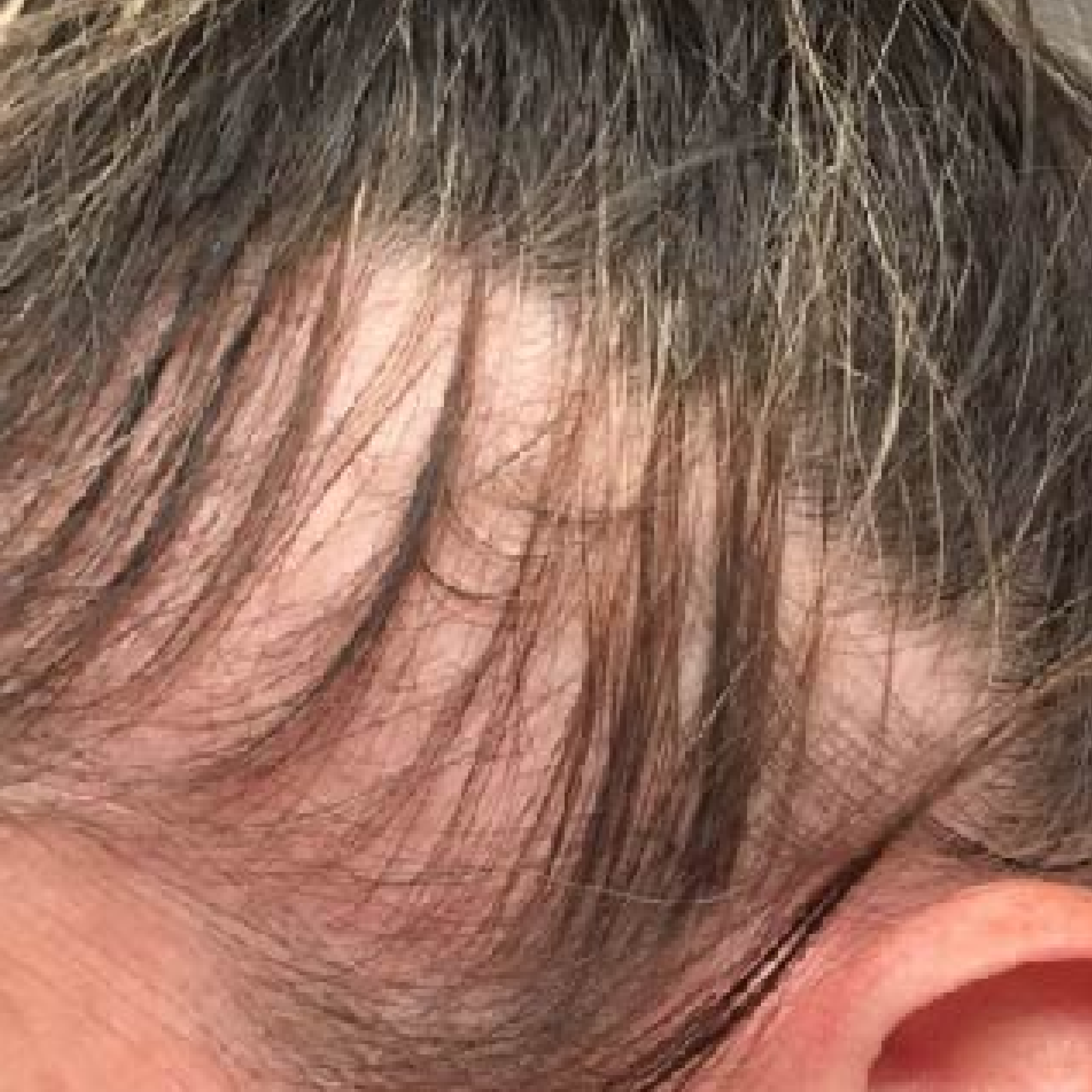 A close-up of a person's scalp showing a patch of thinning dark and gray hair.