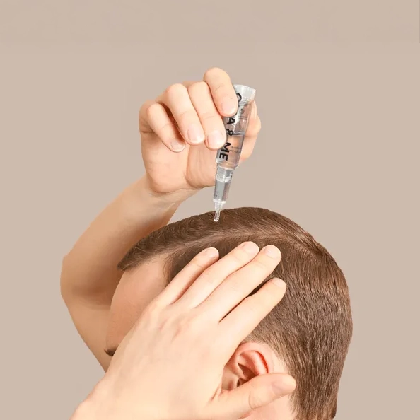 Person applying liquid to scalp with a dropper.