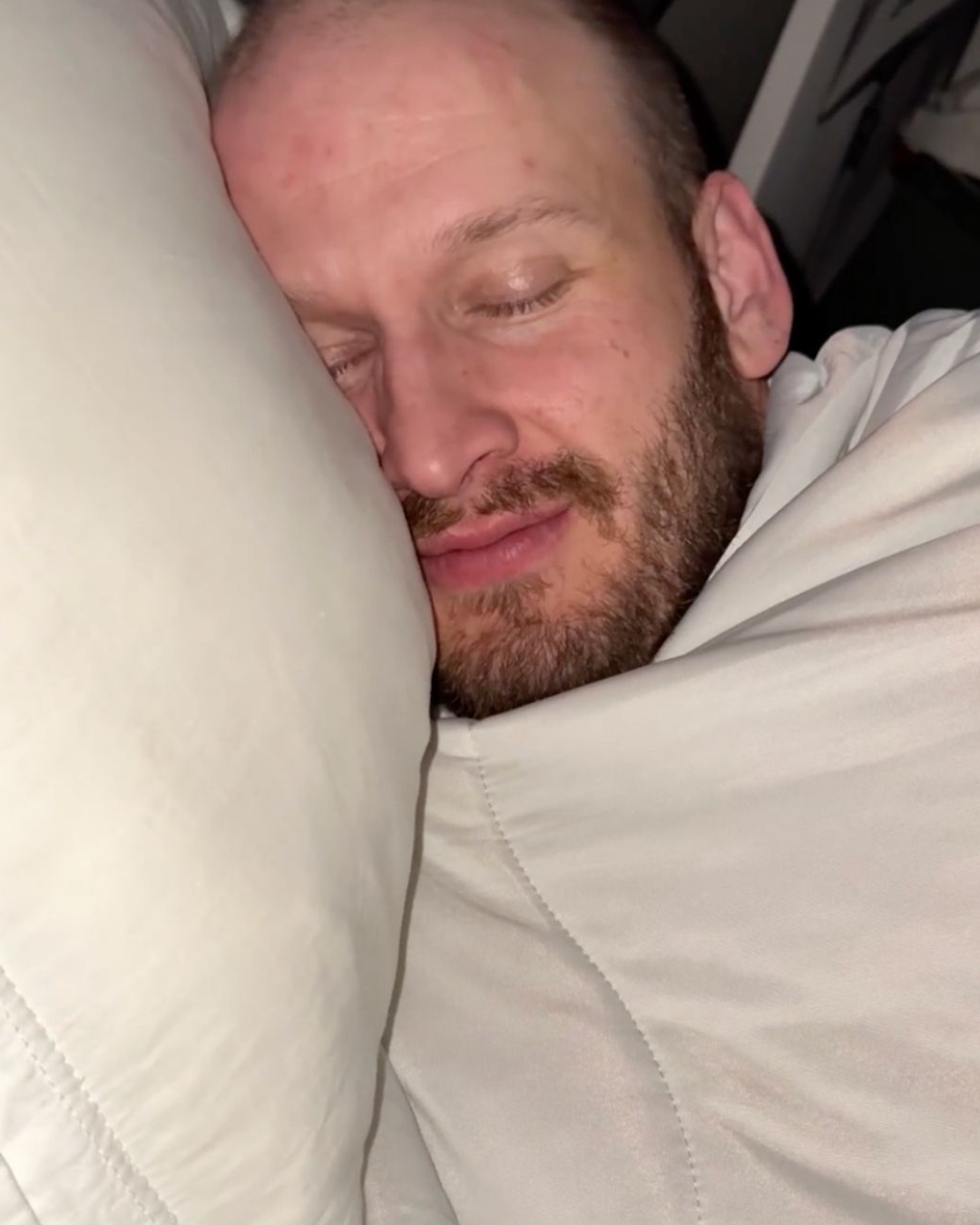 A close-up of a man with a beard sleeping peacefully, his head on a white pillow under a comforter.