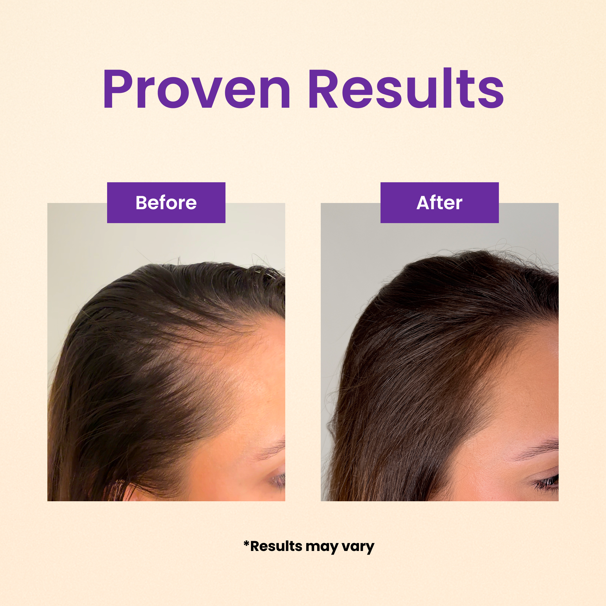 Before and after images showing hair improvement.
