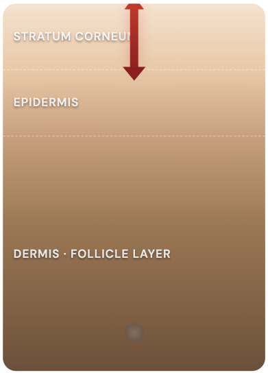 A diagram showing a cross-section of skin layers with labels and a red arrow pointing down.