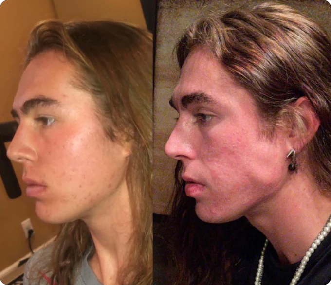 Two side-profile images of a person with long hair, showing different facial expressions.