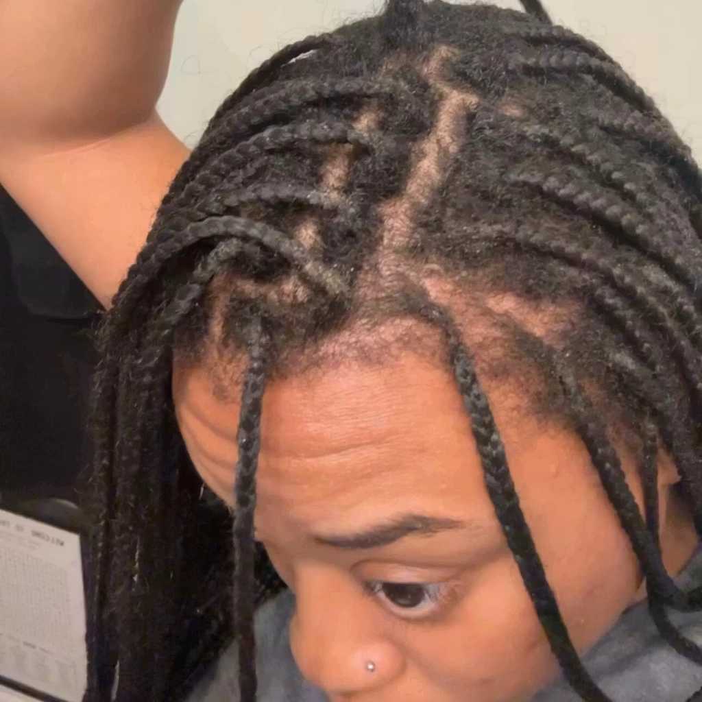 A close-up view of a person's scalp and their black box braids.