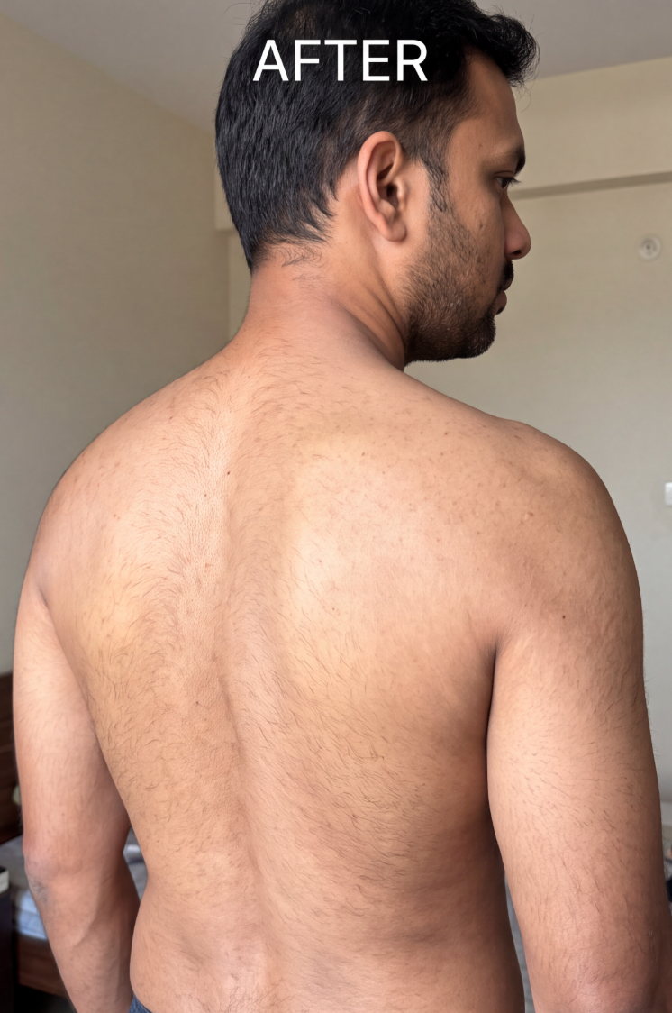 A shirtless man photographed from behind with his head turned to the side, with the word 'AFTER' above.