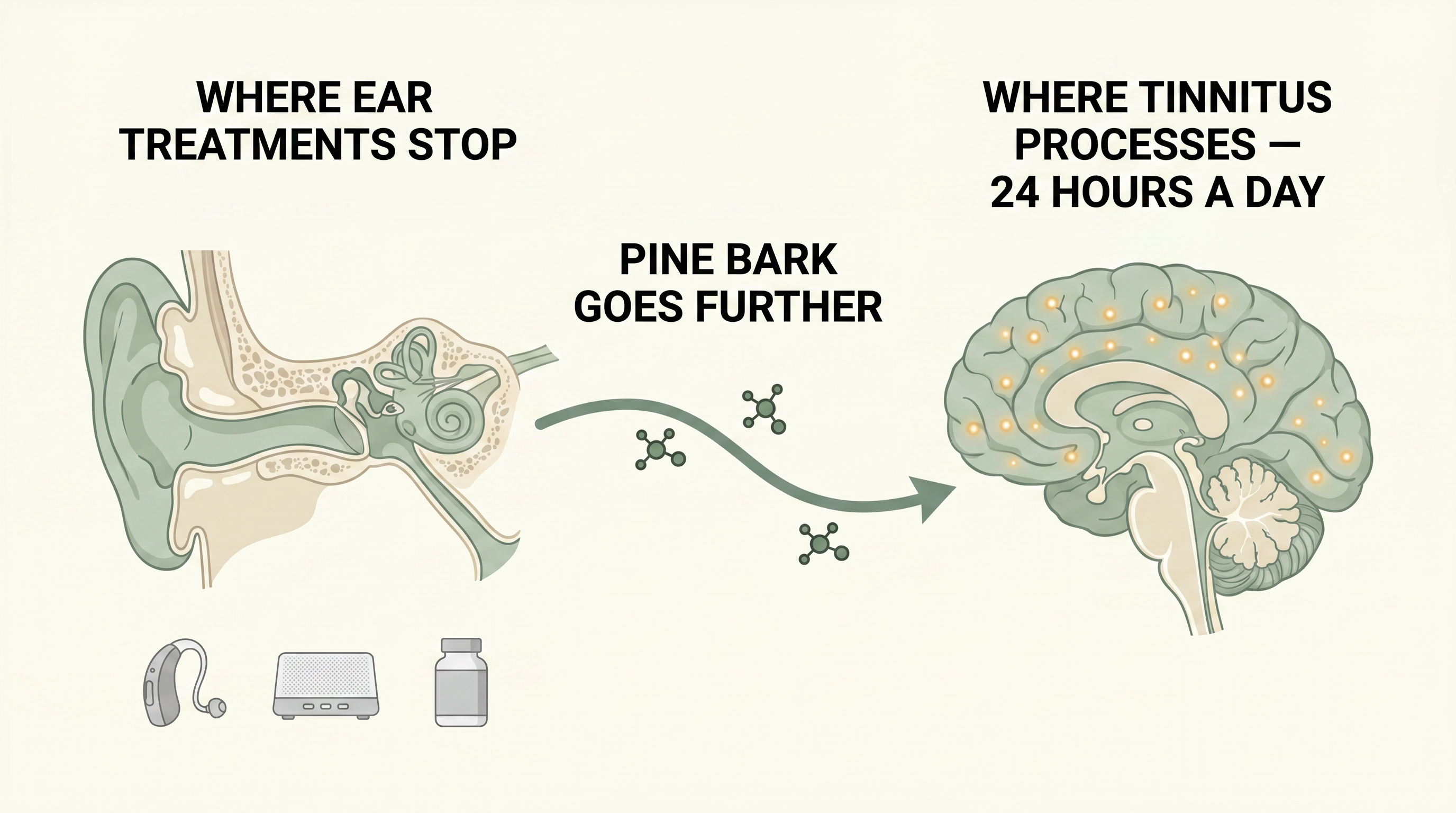 Tinnitus is processed in the brain 24 hours a day