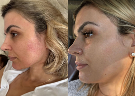 Side-by-side images of a woman's face from different angles.