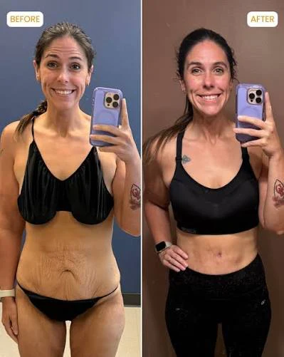 A side-by-side before and after image showing a woman's body transformation.