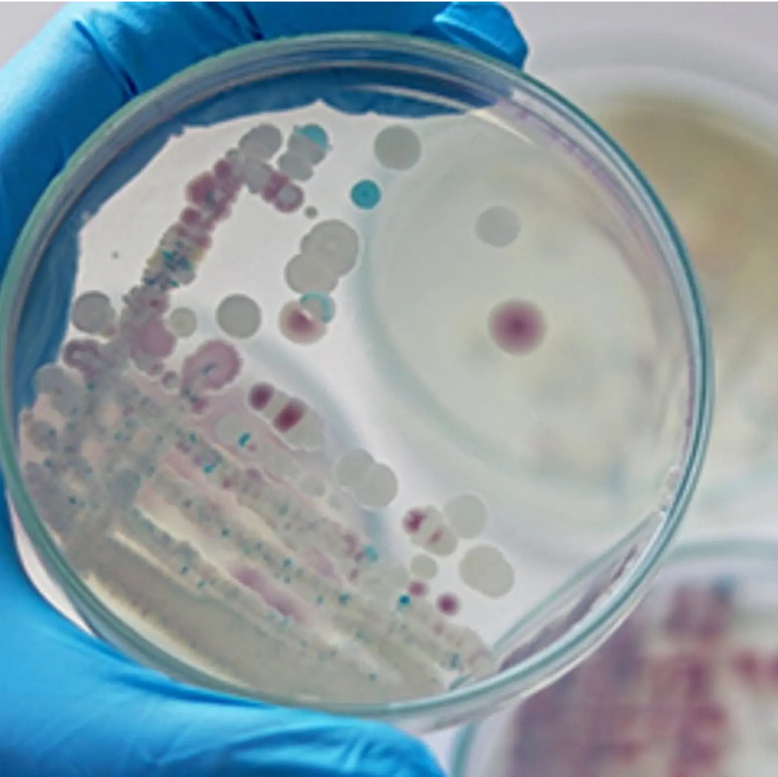 Bacteria colonies in a petri dish held by a gloved hand.