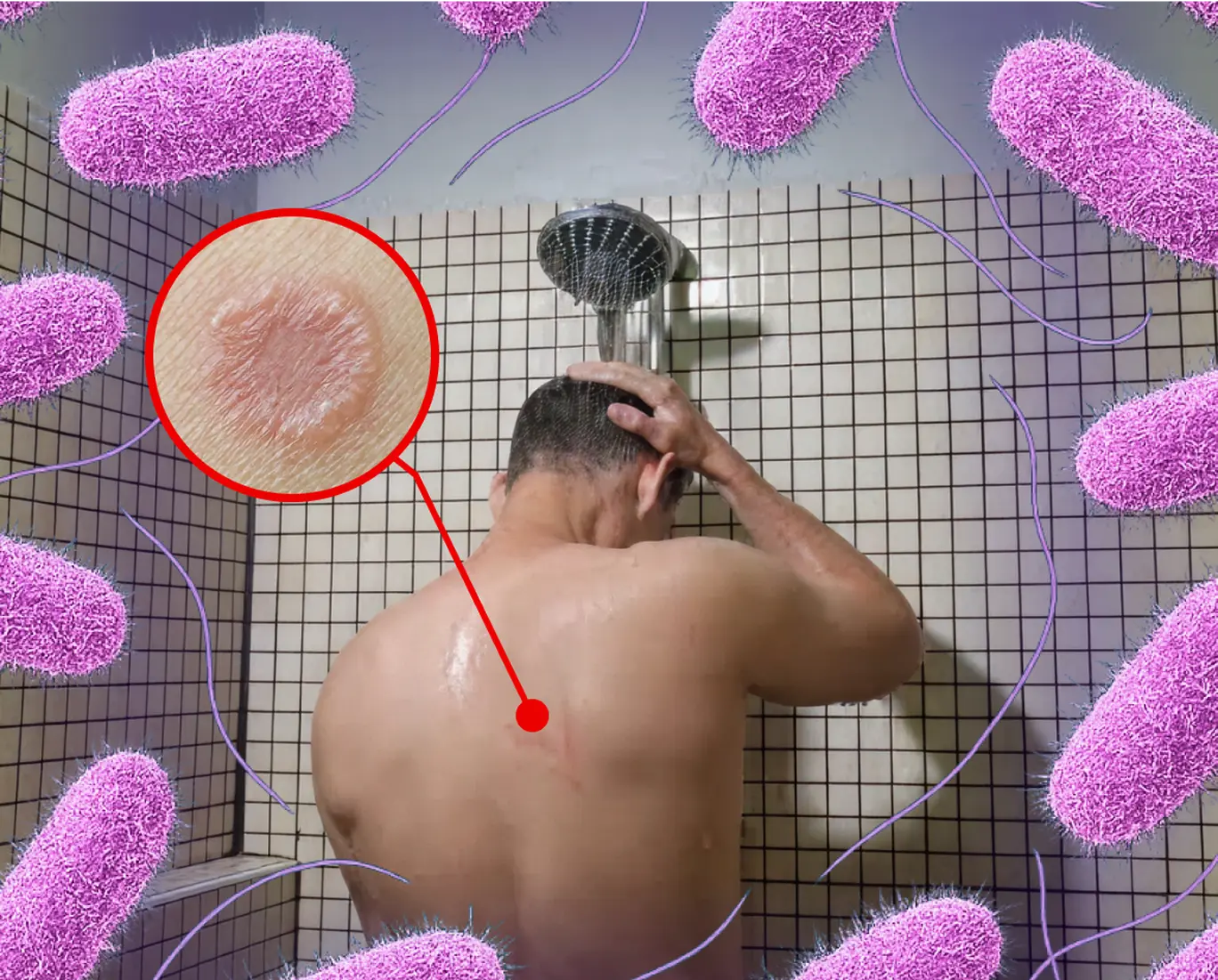 Person showering with bacteria illustration and skin close-up.