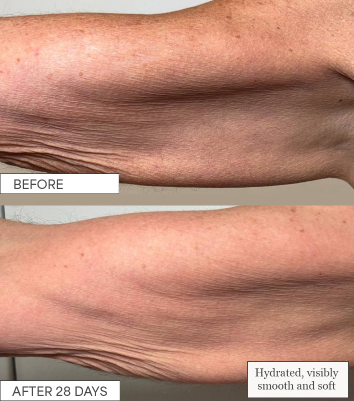 Comparison of an arm before and after 28 days, showing skin improvement.