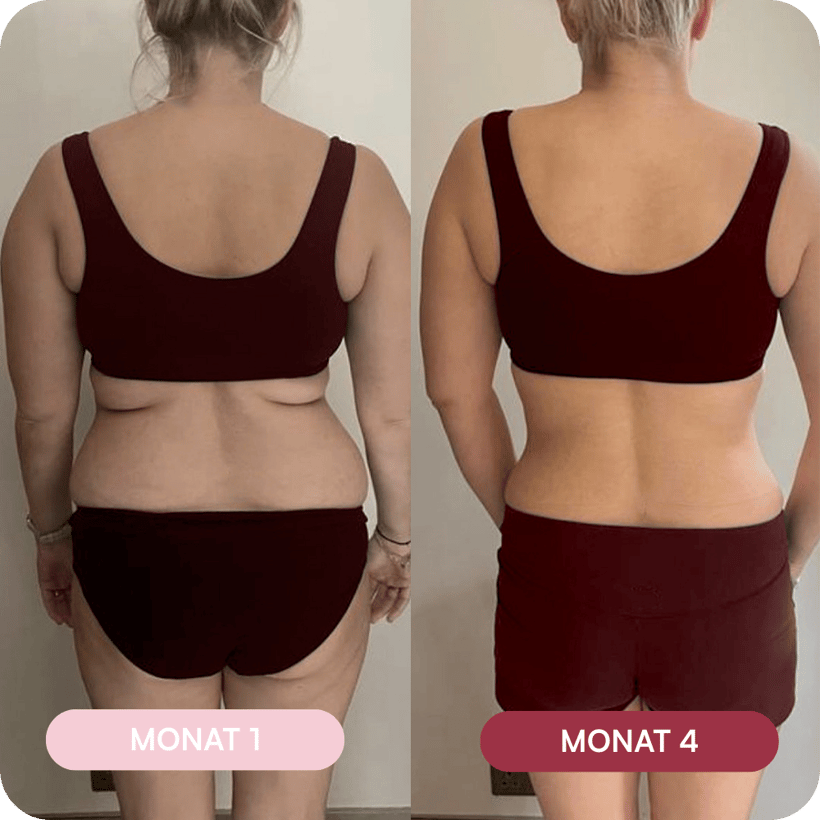 Anna – vorher (Monat 1) und nachher (Monat 4)